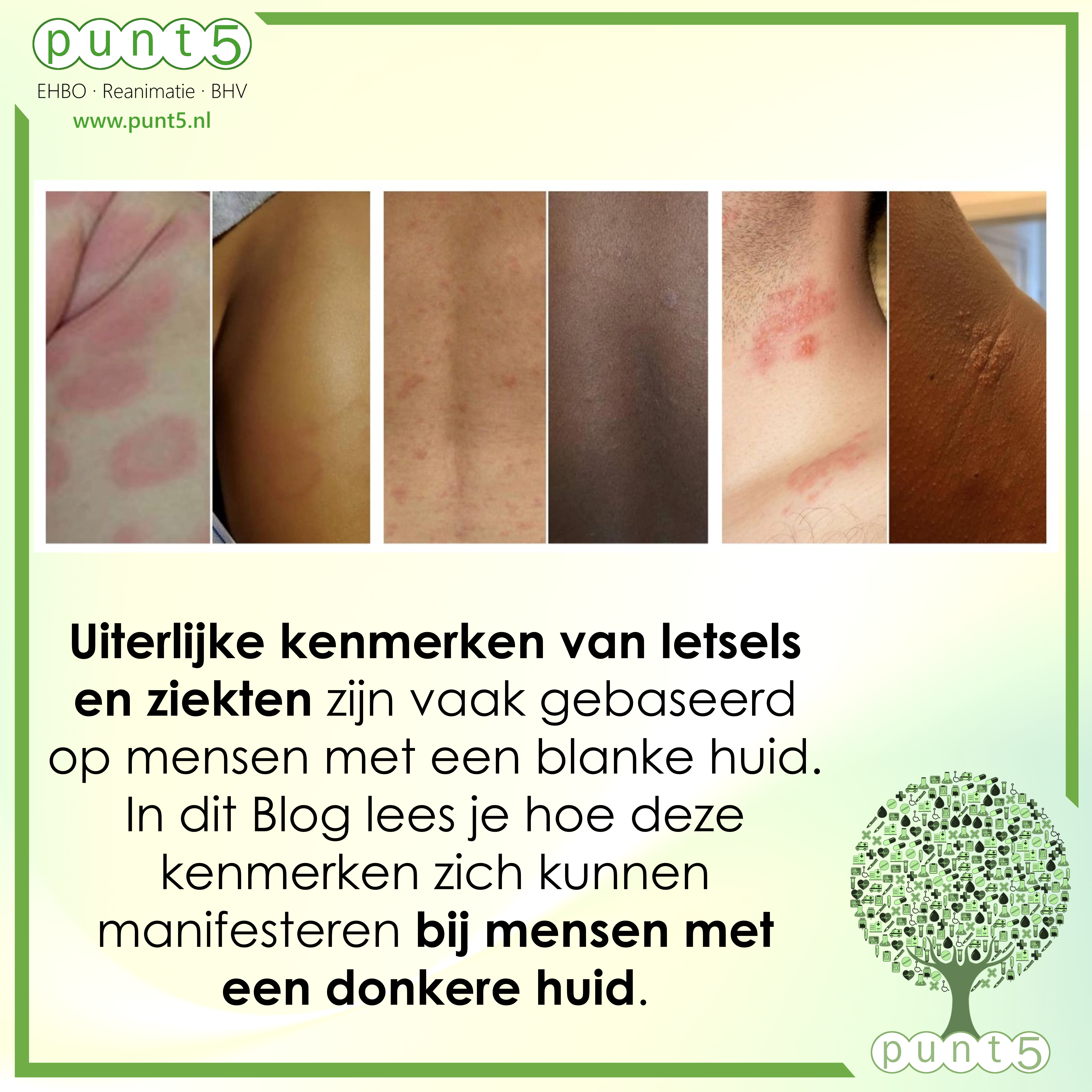 EHBO bij donkere huidkleur